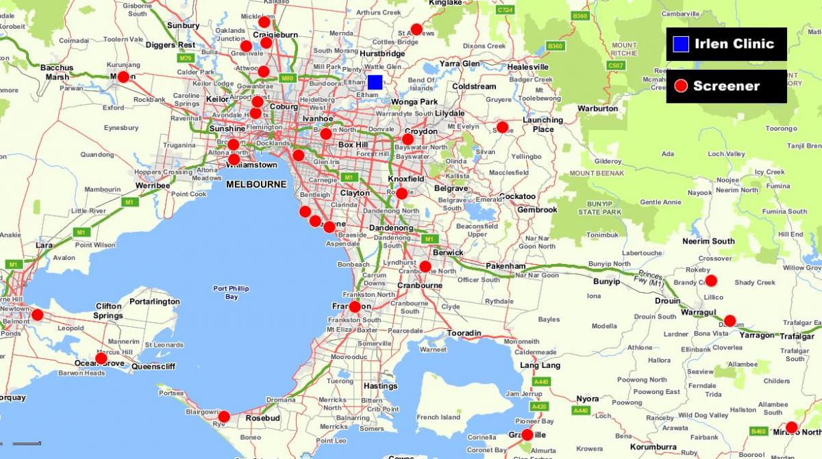 kaart on suurem Melbourne